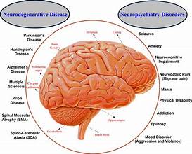 Doctorhub360.com neurological diseases